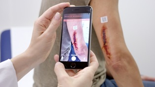 Die Zürcher Jungunternehmer von imito machen Schluss mit den Datenschutz-Risiken bei der Kommunikation medizinischer Smartphone-Fotos 